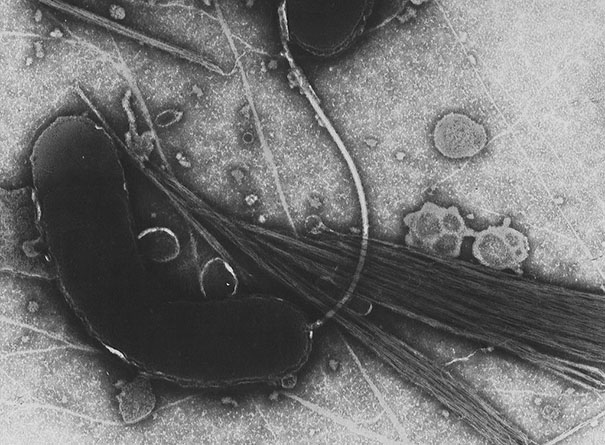 Black and white slide of cholera bacteria.